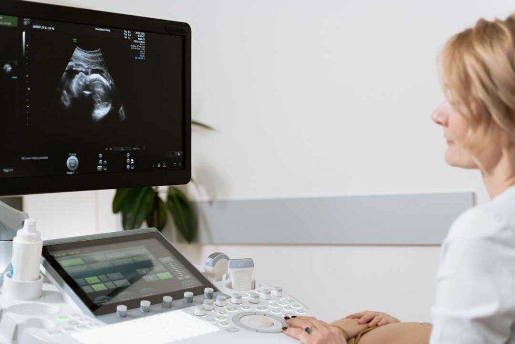 Ärztin schaut auf medizinischen Monitor zur Überwachung des ungeborenen Kindes unter der Geburt